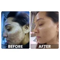https://cdn.sybazzar.com/public/200-200/files/DA875961611C5D3-before.jpg