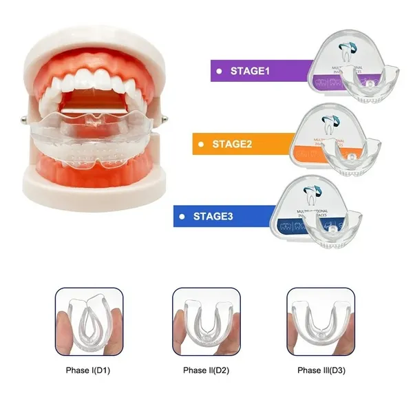 Dental kits brace 3 sets of pack